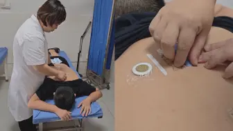 “三伏贴”如何有效进行“冬病夏治”？这份敷贴指南请收好