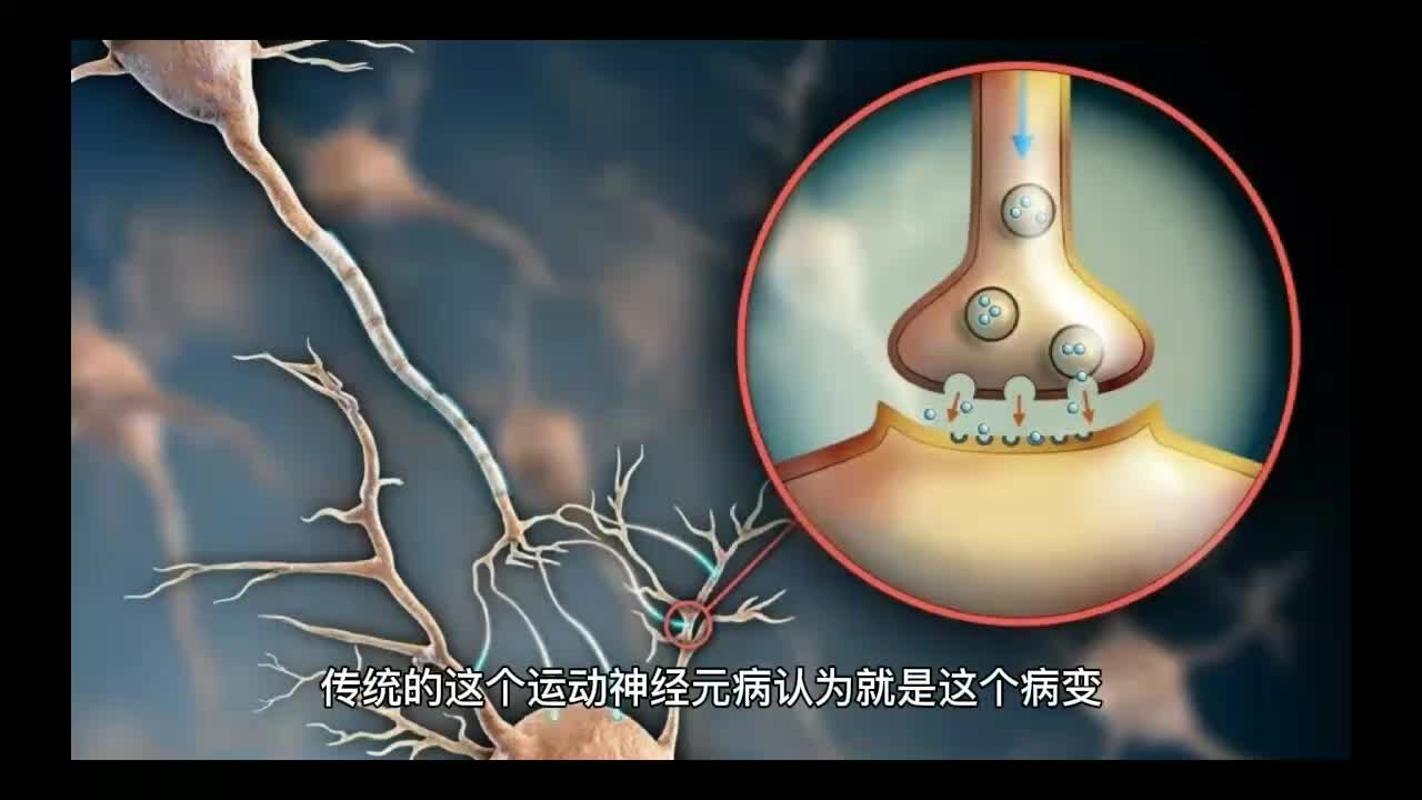 [图]运动神经元病的病人有自主神经系统的损害吗？