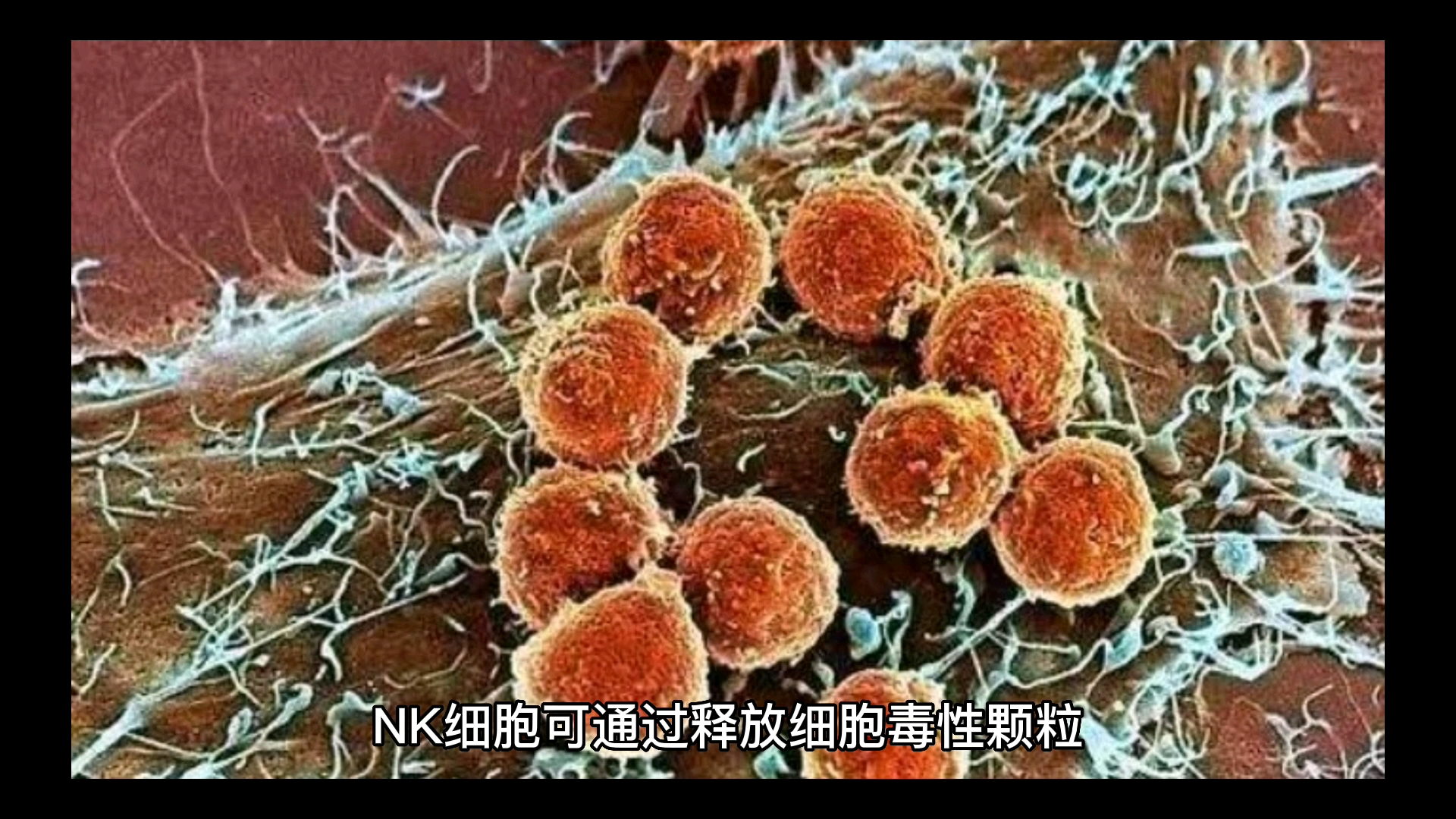 NK细胞被医学界公认为抗癌卫士哔哩哔哩bilibili