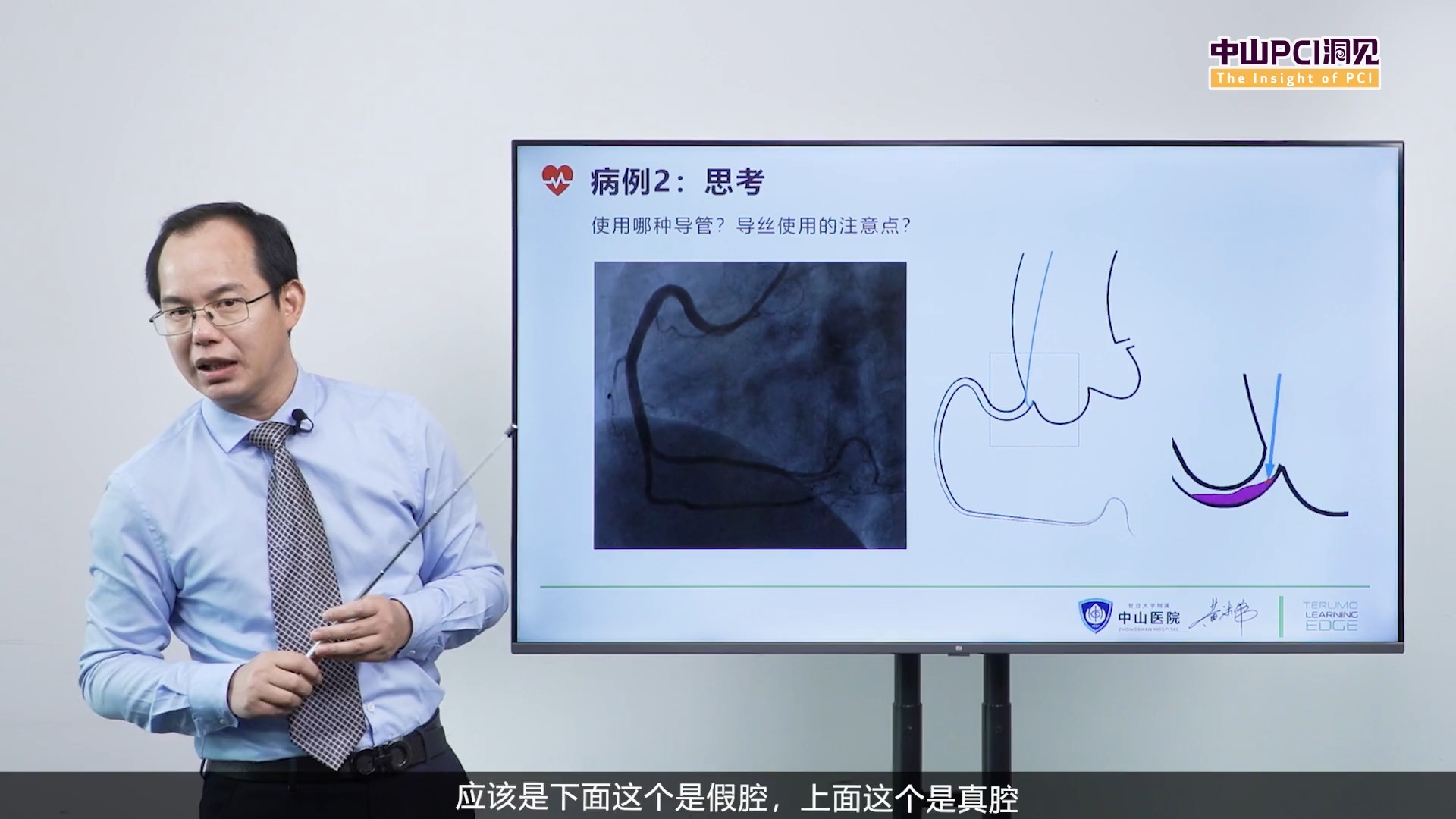 中山PCI洞见|54. 临床病例演示:医源性急性冠脉夹层,导丝如何进真腔?哔哩哔哩bilibili