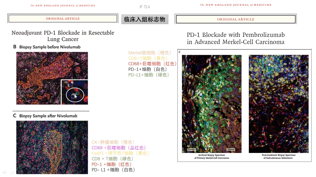 多重荧光免疫组化技术(mIHC)原理及应用分享哔哩哔哩bilibili