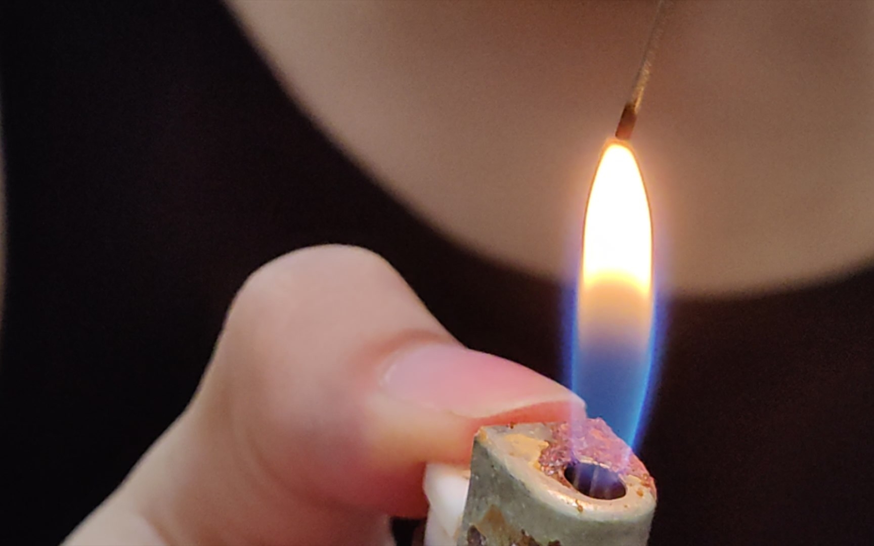 火针点痣_哔哩哔哩_bilibili