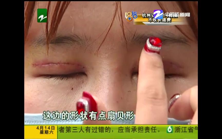 【浙江杭州】女子想要整成“芭比” “眼睛”有些失望哔哩哔哩bilibili