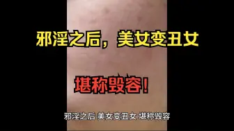 Tải video: 邪淫之后，美女变丑女，堪称毁容