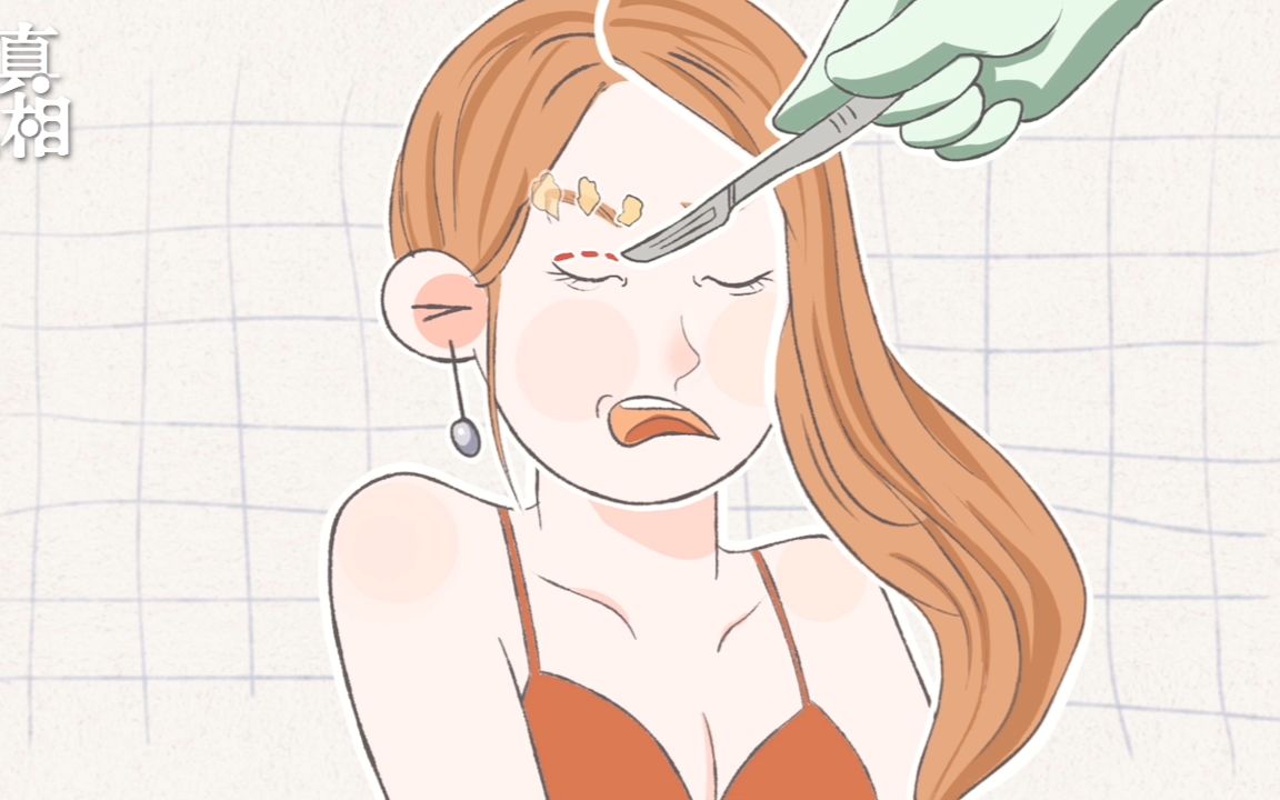 真美颜割双眼皮怕割毁了这些注意事项你需要知道