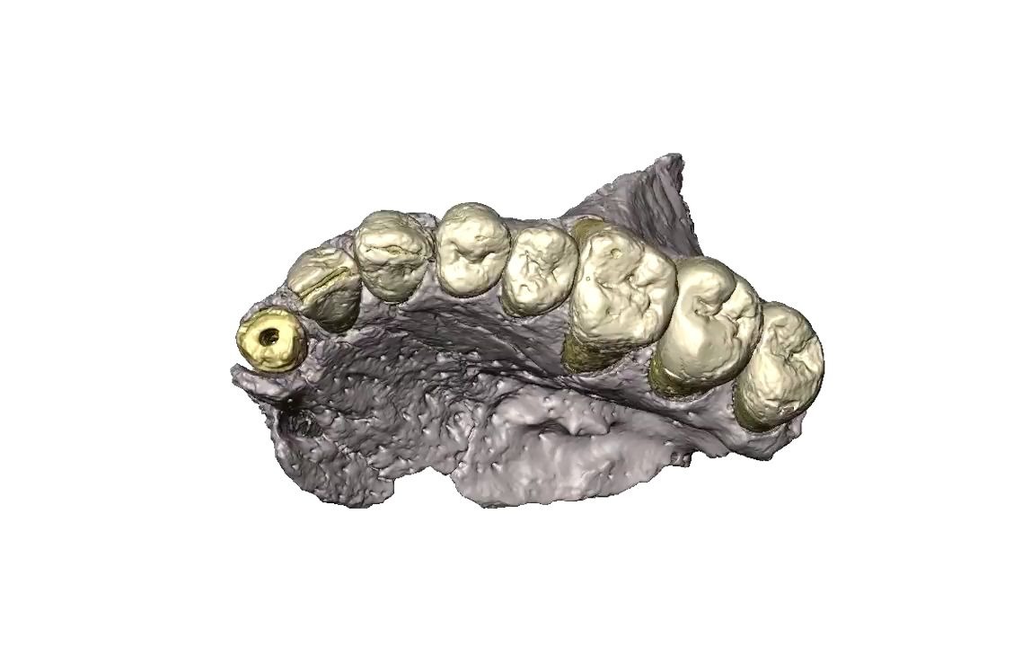 [图]以色列Misliya洞穴的现代人类化石的3D重建