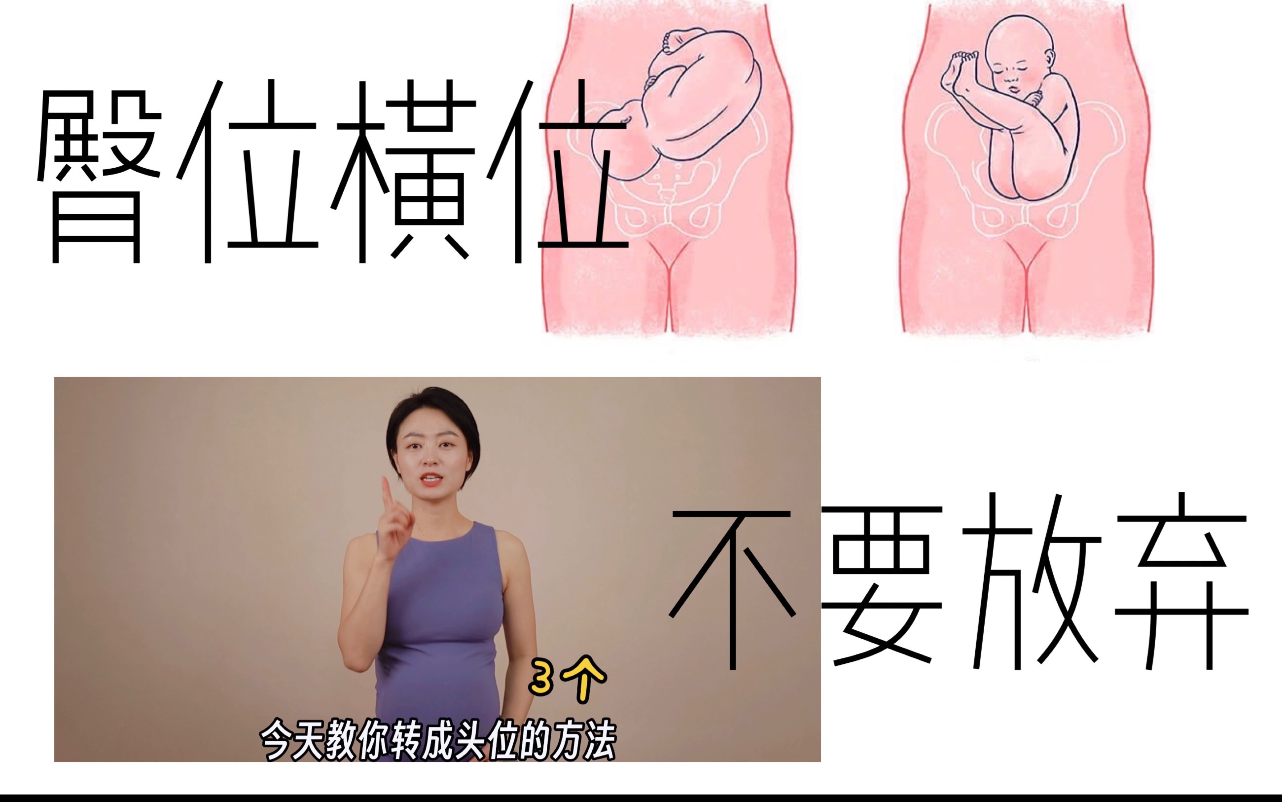 臀位怎么调整过来 臀位孕晚期要多躺着么?应该怎样转正胎位呢?