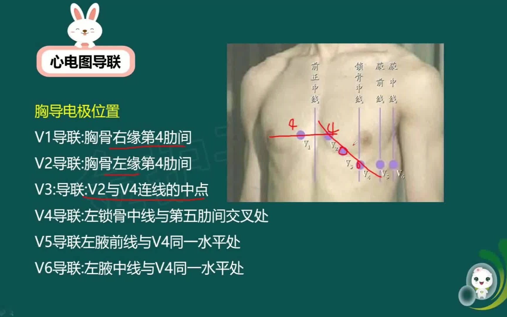 【金护子教育】2021年护考图片专题之心电图导联知识点汇总三哔哩哔哩bilibili