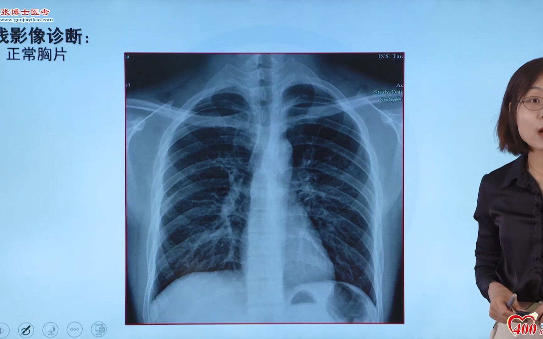 正常肺ct片子图片