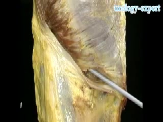 腹股沟管 Inguinal region哔哩哔哩bilibili