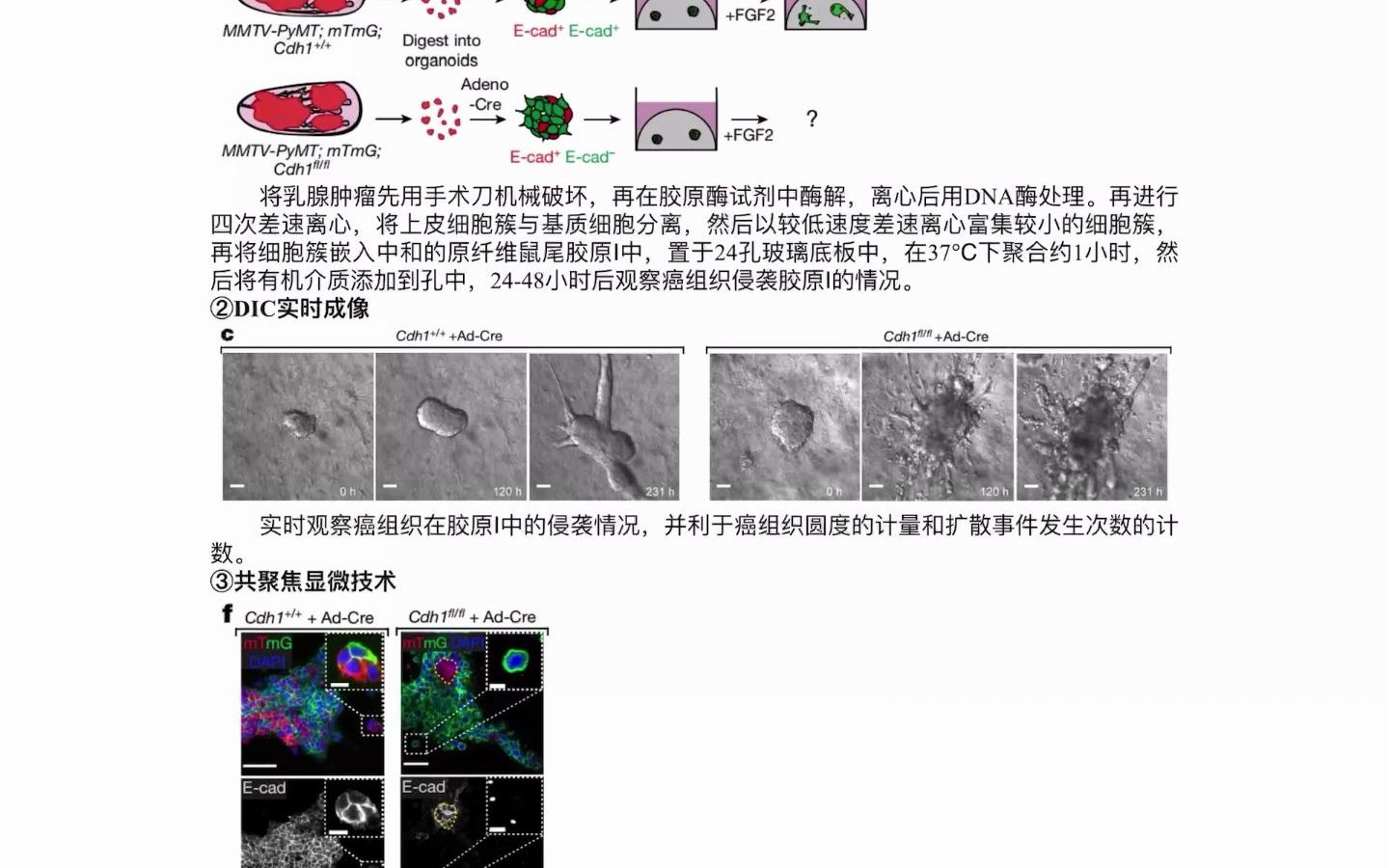 文献分享Ecadherin与乳腺癌细胞侵袭、转移哔哩哔哩bilibili