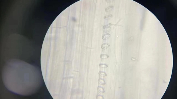 梨果实的石细胞显微镜图片