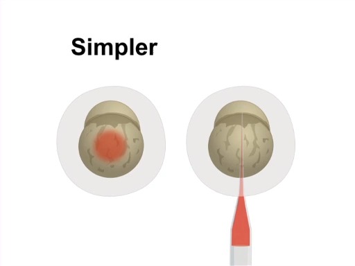 Zebrafish Microinjection Technique