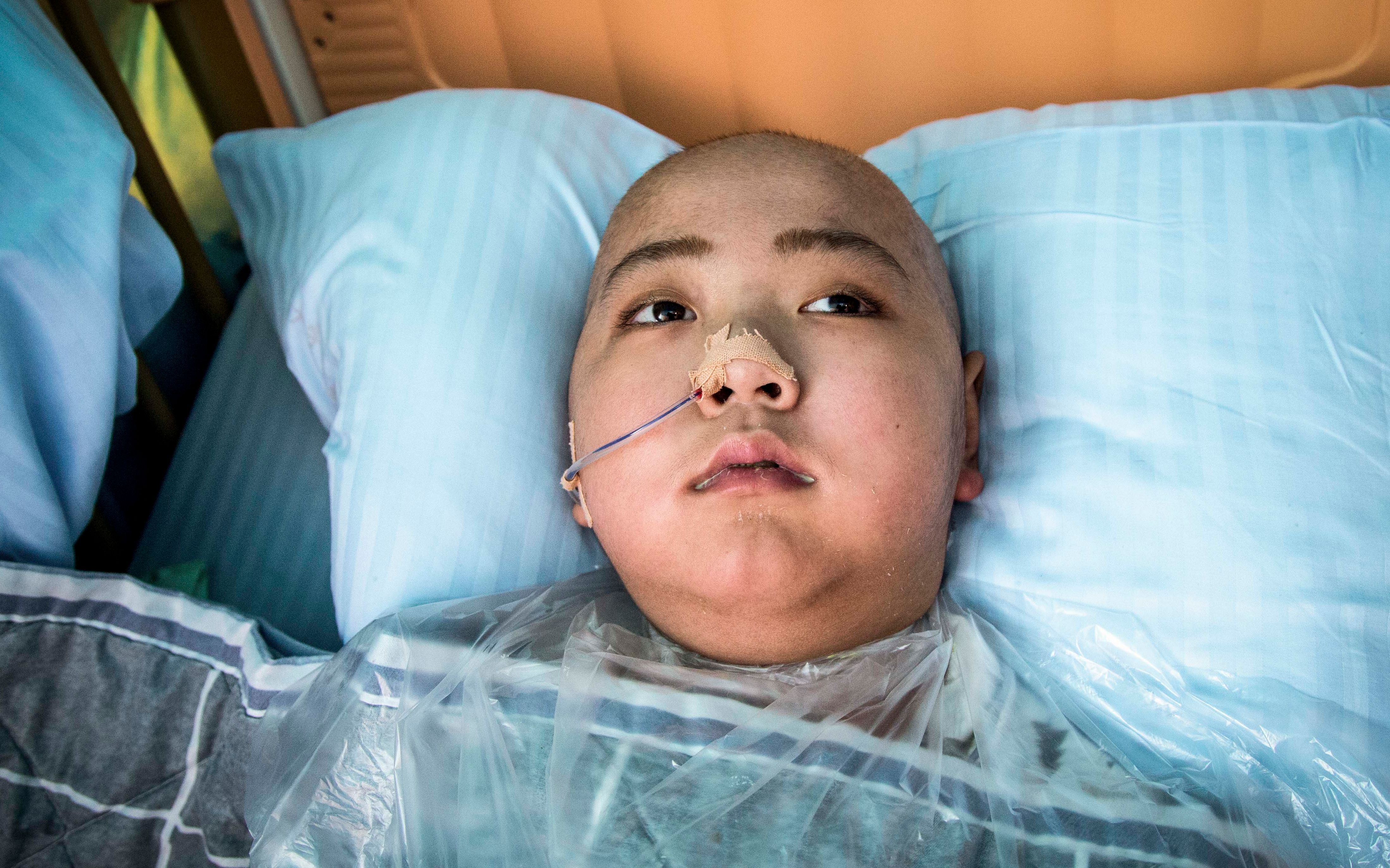 安徽8岁男孩患重症不到半年形同植物人,眼看就能挺过去钱却没了