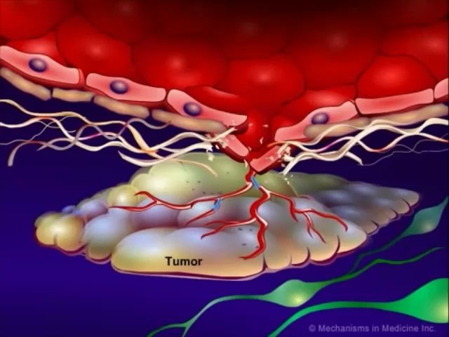 解读肿瘤君之第四部曲—肿瘤的血管生成哔哩哔哩bilibili