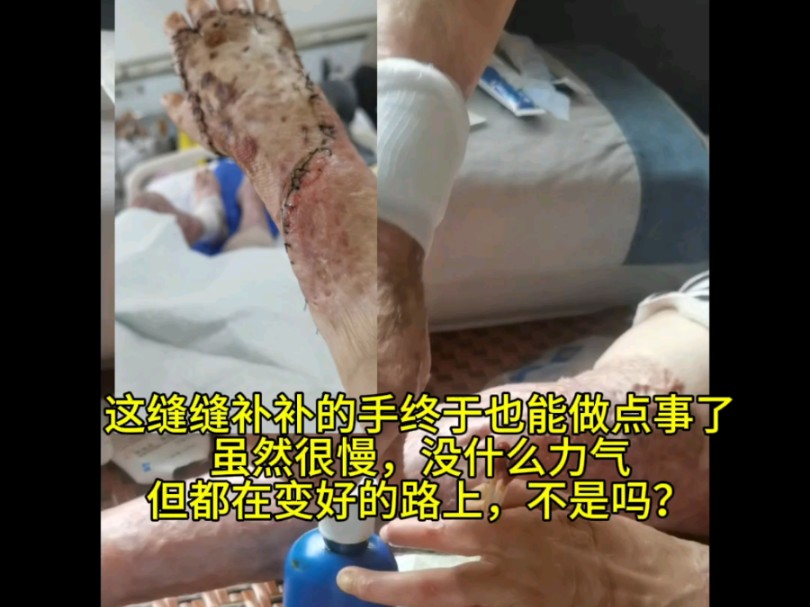 嗯呐,只要在变好,慢一点又何妨,加油𐟒꥓”哩哔哩bilibili