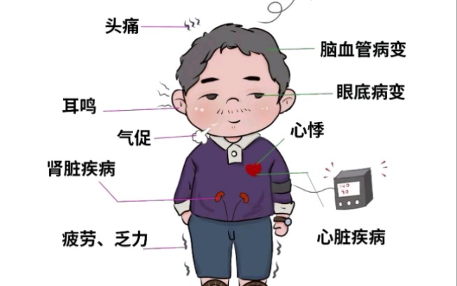 高血压临床表现