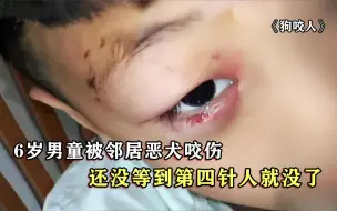 Download Video: 6岁男童被狗咬伤致死，离第四针疫苗仅差两天 ，狗主人：不关我事