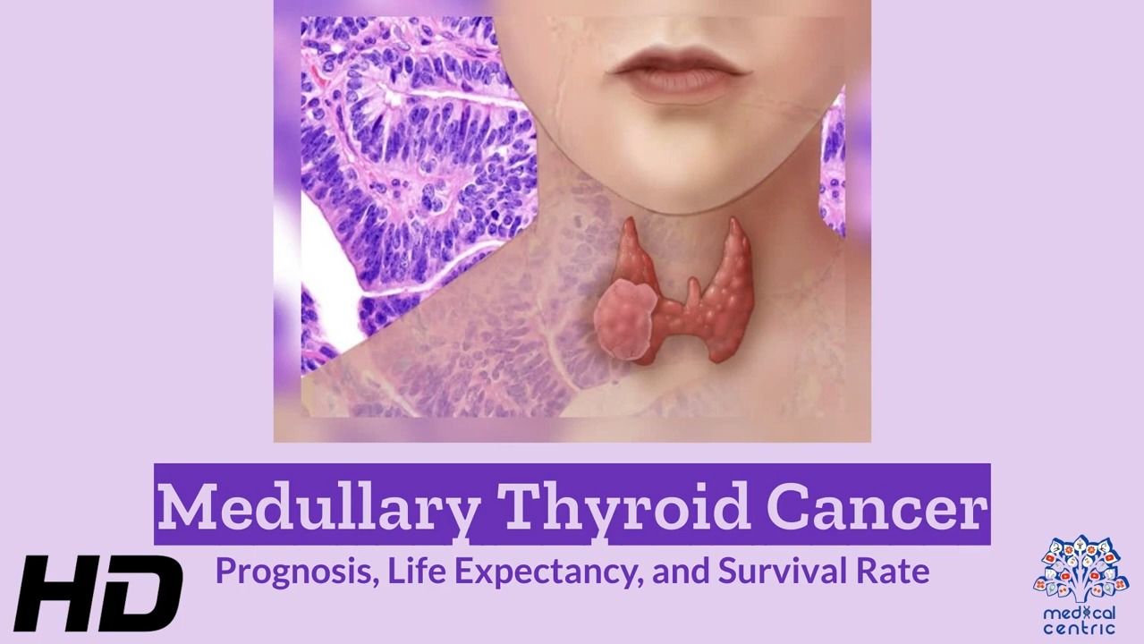 【医学双语视频】甲状腺髓样癌 Medullary Thyroid Carcinoma | 预后 预期寿命及生存率 | 医学双语 考博英语听力练习哔哩哔哩bilibili