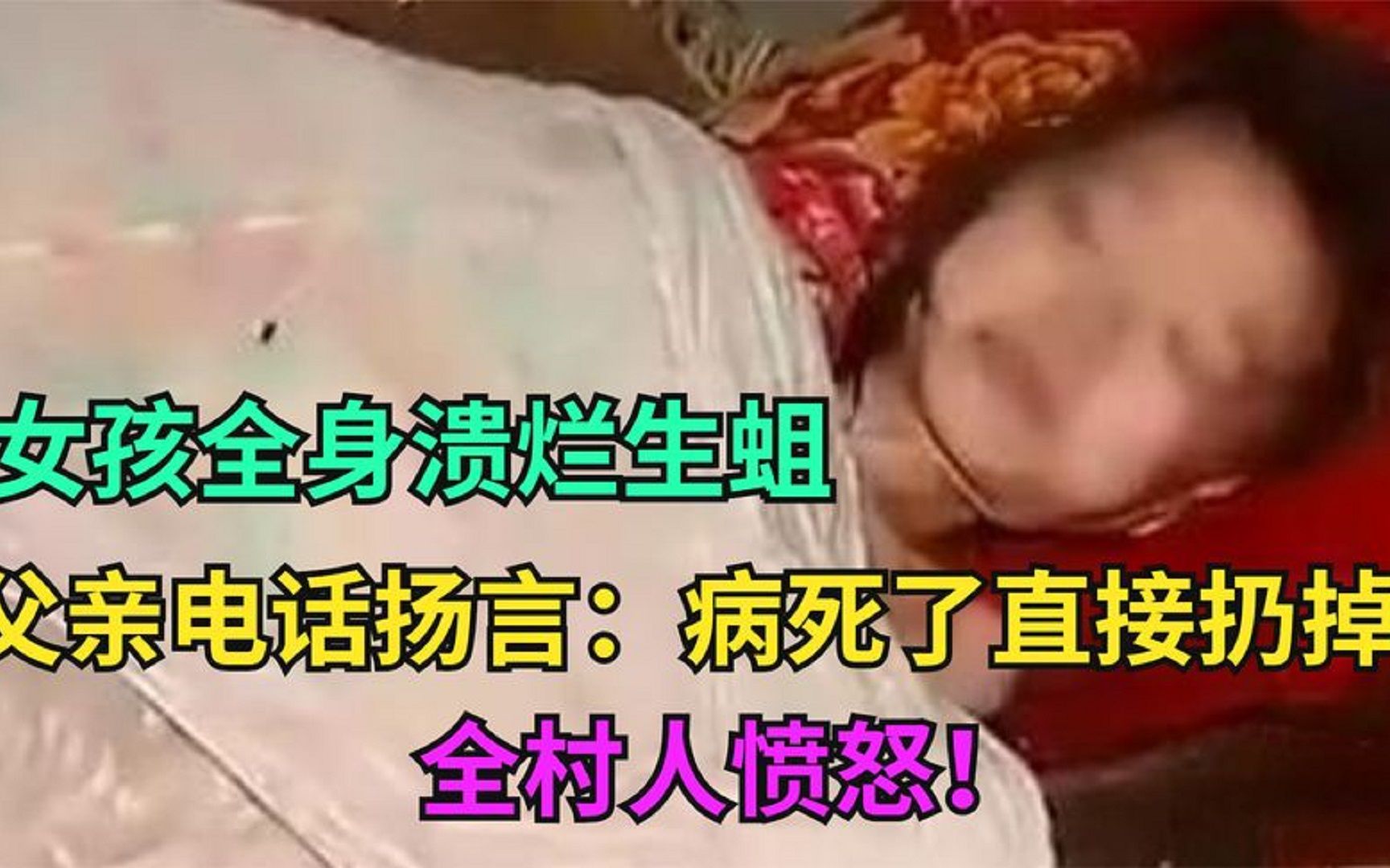 [图]可怜女孩惨的怪病，全身溃烂生蛆，父亲见状狠心将女儿抛弃