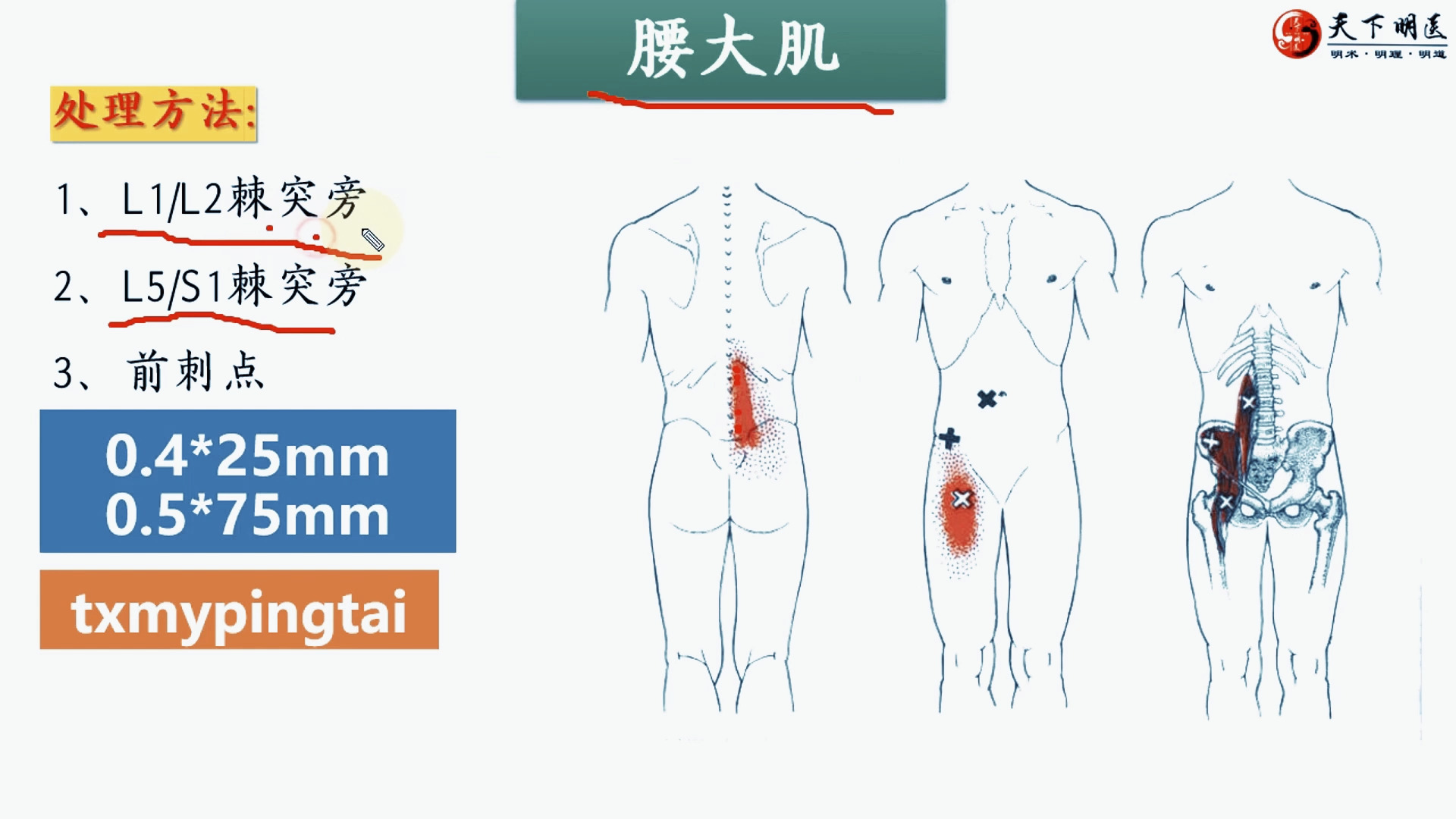 腰大肌的位置,腰大肌的功能,腰大肌的激痛点,腰大肌损伤后的症状,腰大
