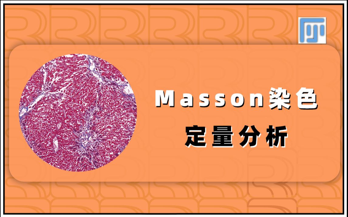 动物实验合集(10):Masson染色定量分析哔哩哔哩bilibili