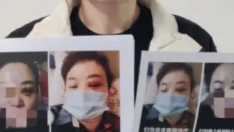 女子称被企业家丈夫长期家暴，离婚后要不回抚养权，当地多方回应