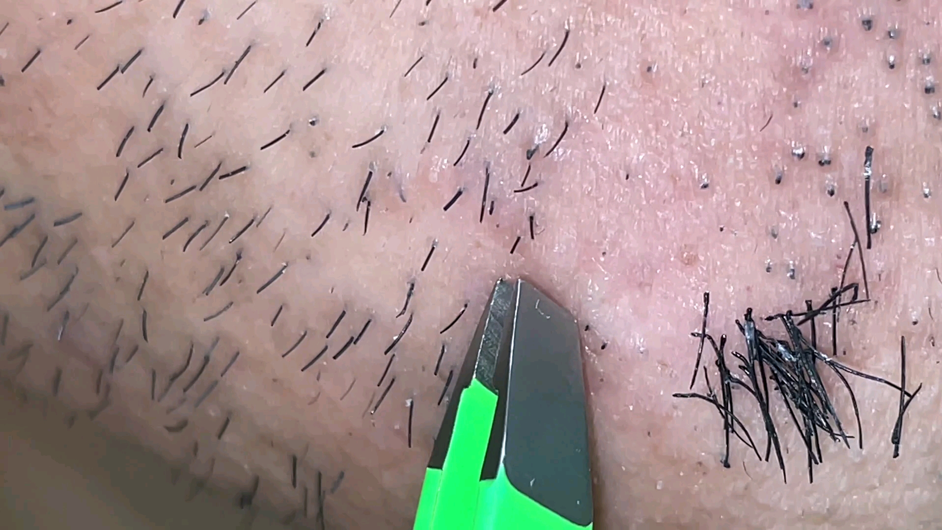 日常拔下巴胡子(但三倍速)