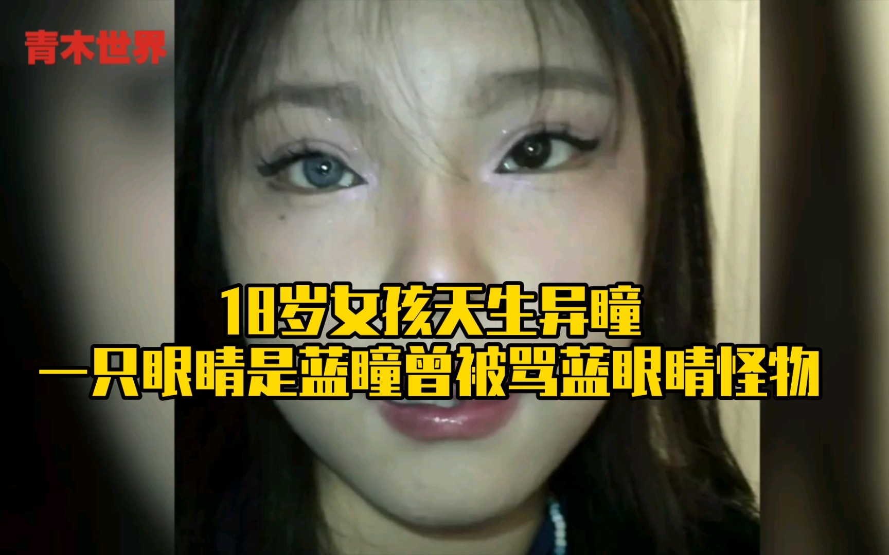 [图]18岁女孩右眼天生蓝瞳，被骂蓝眼怪物，朋友使我自信