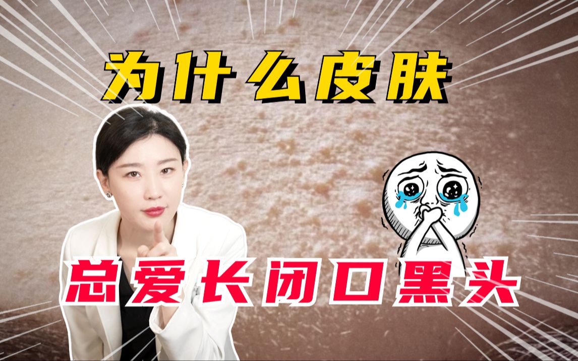 为什么皮肤总爱长闭口黑头?哔哩哔哩bilibili