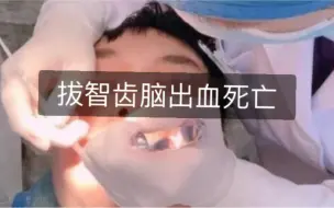 Download Video: 小伙拔智齿10天后脑出血死亡