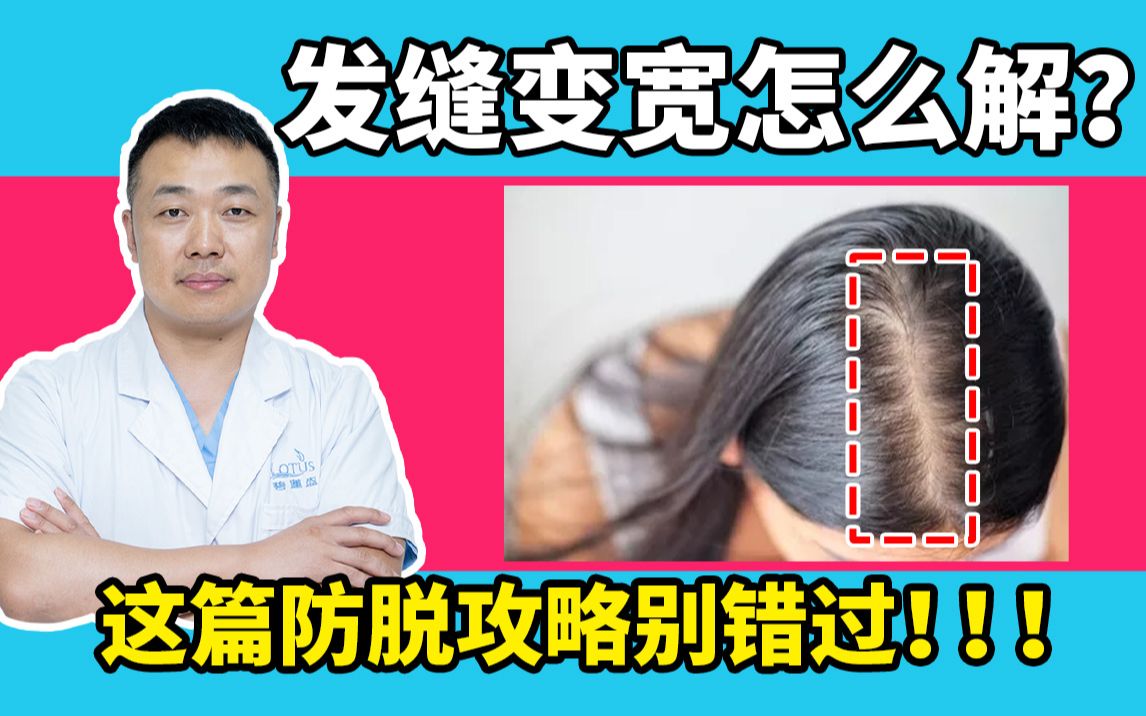 发缝变宽怎么解?这篇防脱攻略别错过!!!哔哩哔哩bilibili