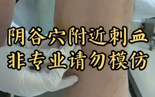 Download Video: 阴谷穴附近刺血，立刻轻松！（附陈教授方剂：麻黄6连翘15赤小豆15白鲜皮15地骨皮15玄参10生地15地肤子10羌活15黄芩10防风10荆芥10甘草10）