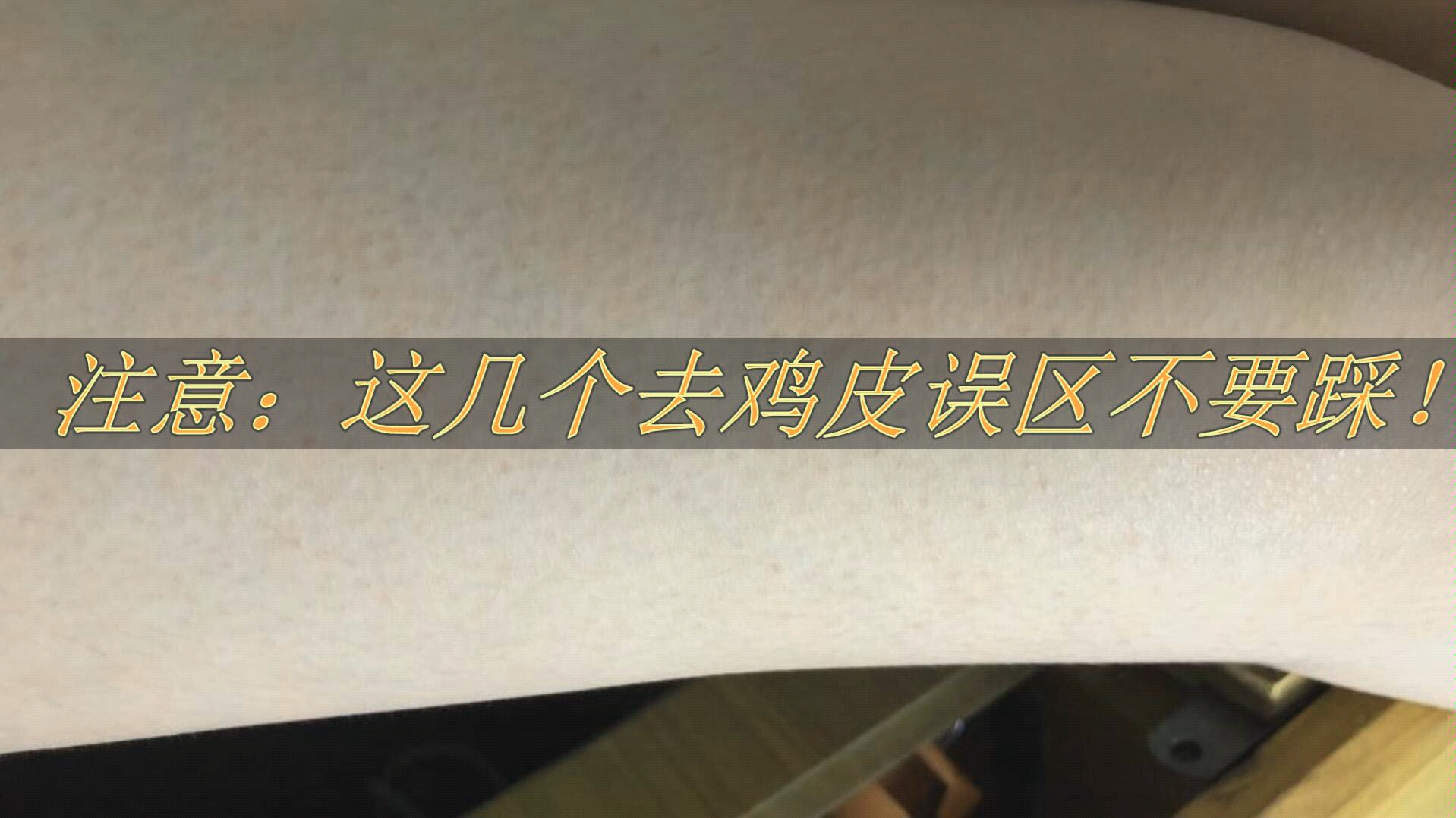 鸡皮肤可以用氢醌霜(氢醌霜能涂正常皮肤吗)