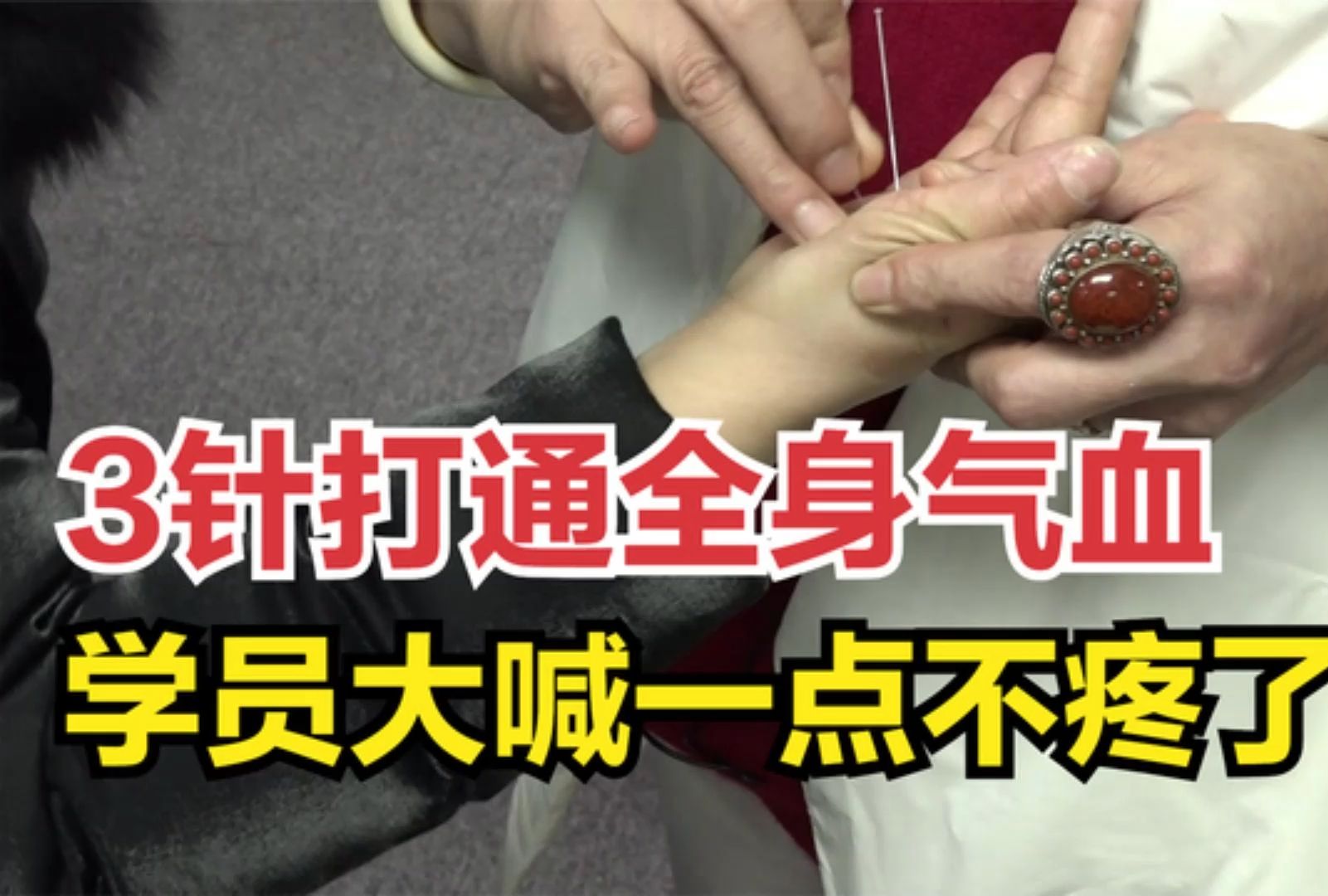 后背疼痛多年,中医3针打通全身气血,学员大喊不疼了!