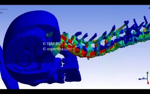 Video herunterladen: 基于Ansys 显示动力学的颅骨压缩冲击的模拟