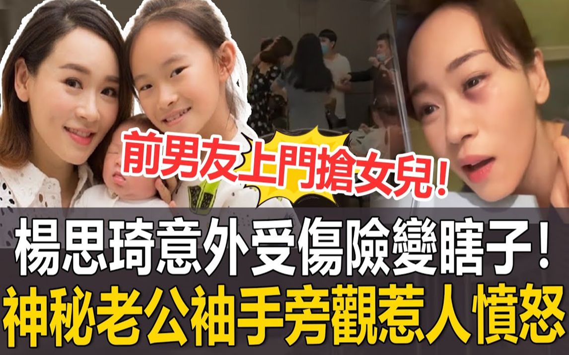 前男友上门抢女儿!杨思琦意外受伤险变瞎子,神秘老公袖手旁观至今不愿露面!态度恶劣惹人愤怒! #杨思琦哔哩哔哩bilibili