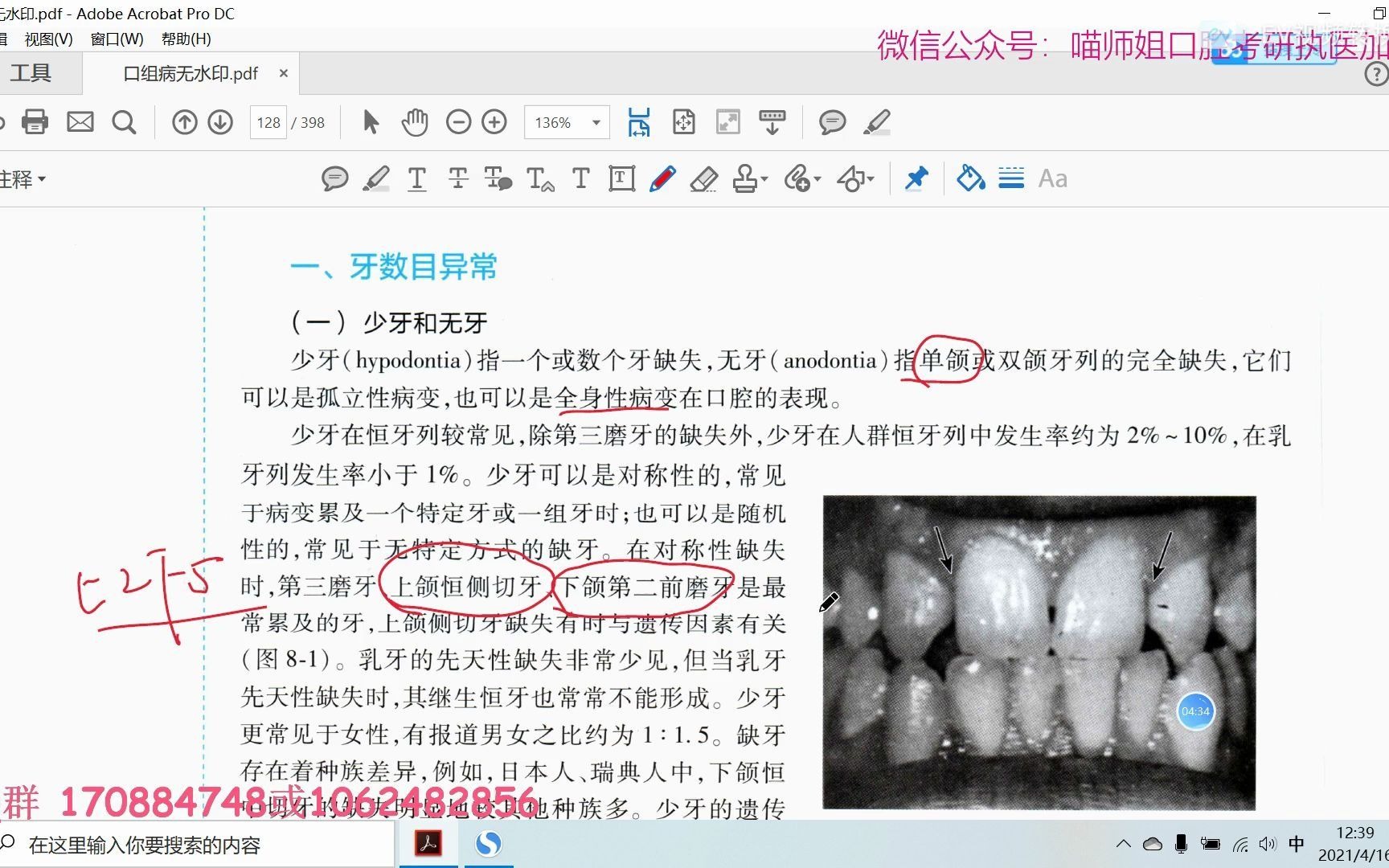 [图]口腔组织病理学人卫新教材第八章牙发育异常