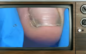 撬开里面好多黑泥