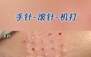 Download Video: 打水光：手打、机打、滚针分别有什么优缺点？