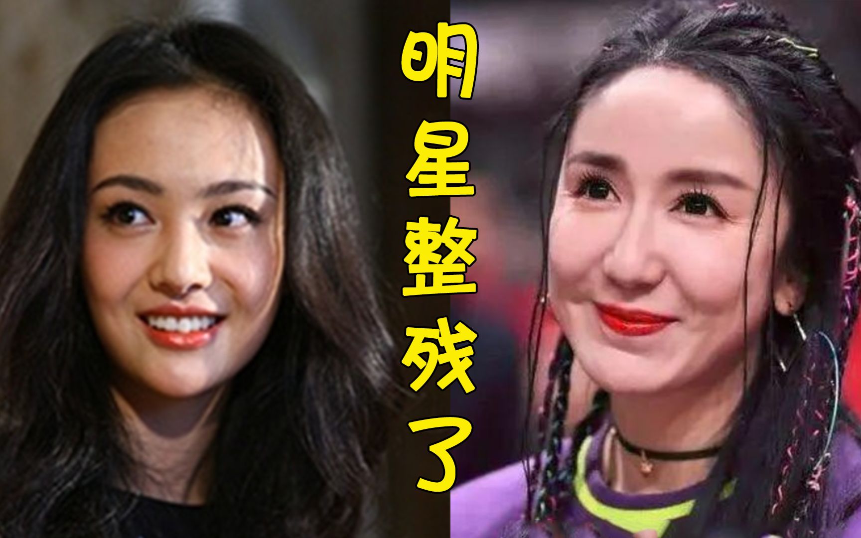 有种扎心叫明星整残了,娄艺潇女神变女鬼,李小璐惨变僵尸脸,最后一