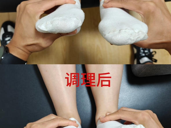 解决足背屈功能受限并不难