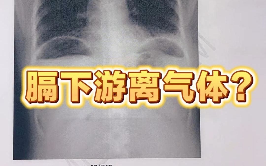 膈下游离气体见于什么病症?