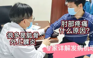 Video herunterladen: 肘部疼痛什么原因？很多是肱骨外上髁炎，专家详解发病机理