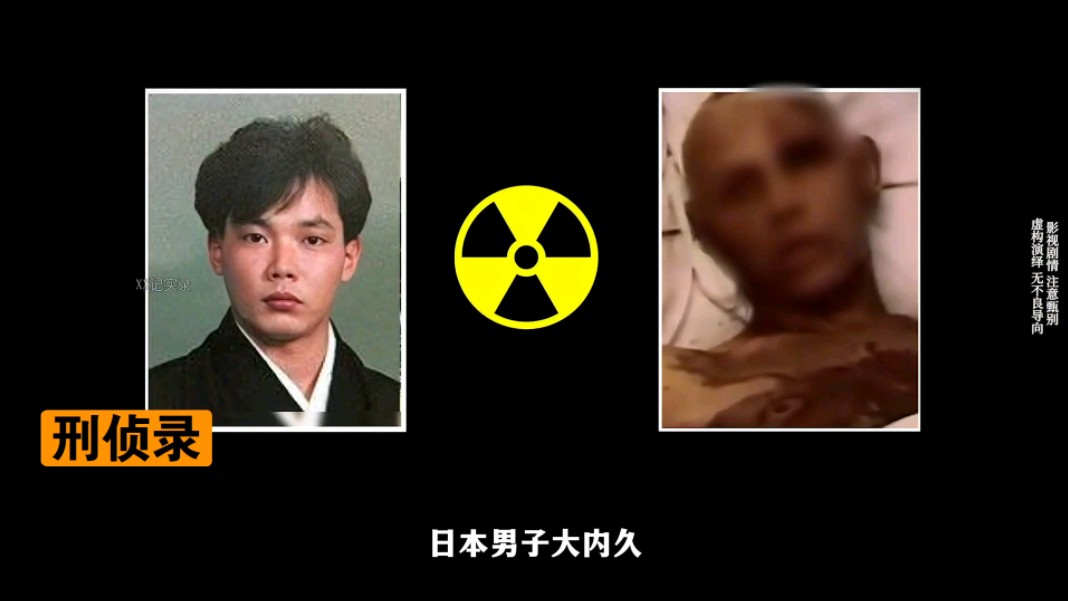 他被近距离核辐射后,亲眼目睹自己腐烂融化,被强行续命83天
