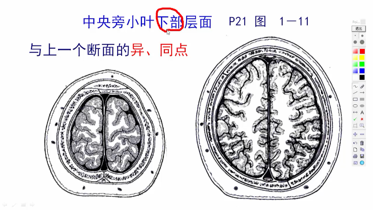 [图]头部断层