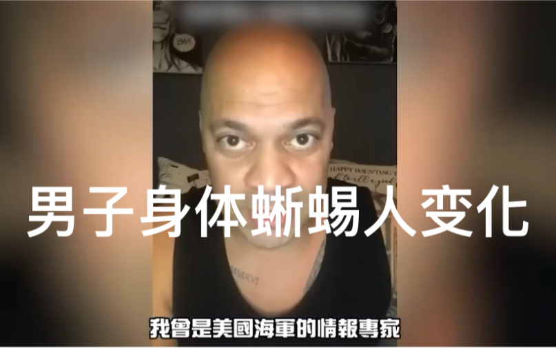 [图]男子身体蜥蜴人变化.是男子在美国海军服役暗示参加了超级士兵计划，并在2016年接受了脑际接口。