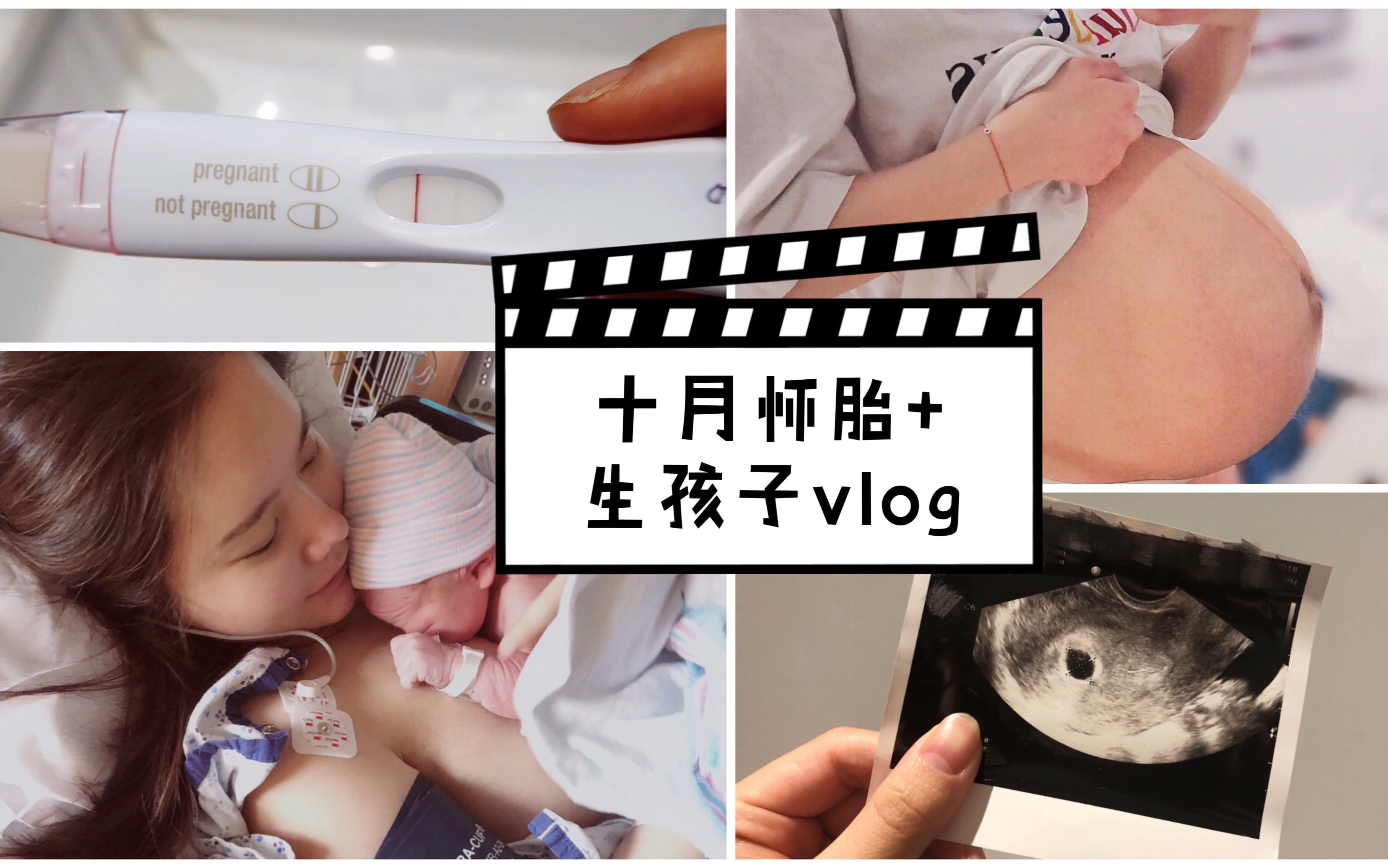 我的十月怀胎+生孩子全过程vlog | 产房12小时 顺产转刨腹一波三折 | Ann Lyn 林安安哔哩哔哩bilibili