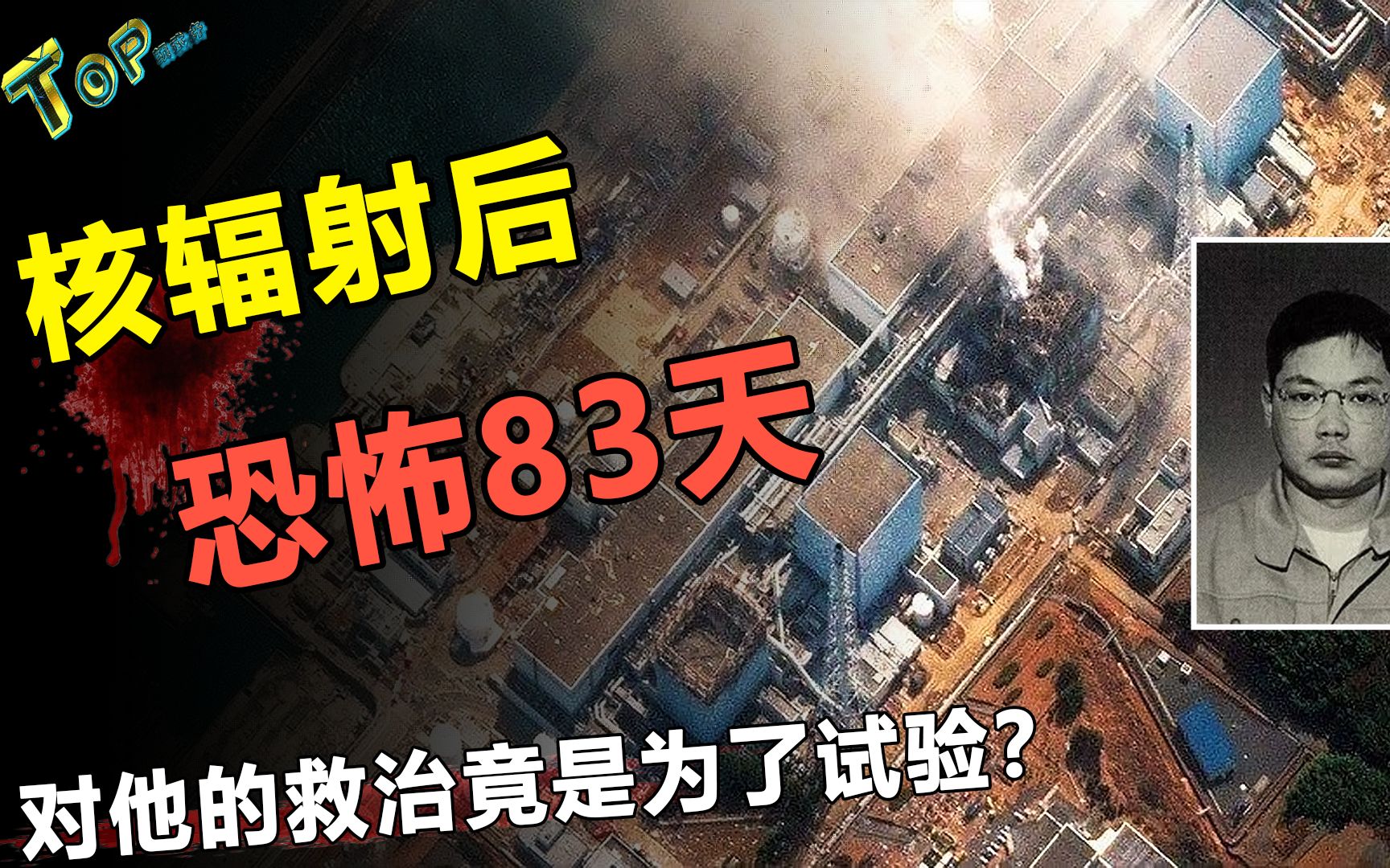 日本核辐射83天死亡图片