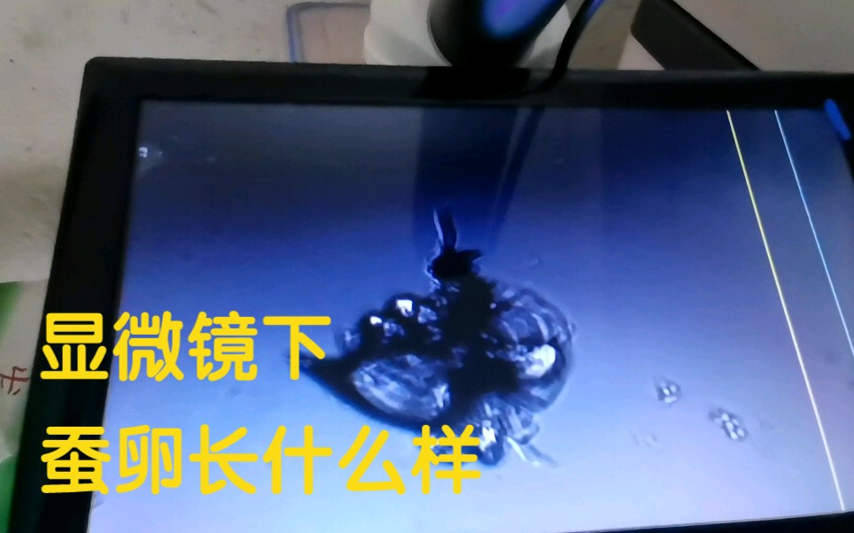 把蚕卵放显微镜上放大2000倍,看看长什么样哔哩哔哩bilibili